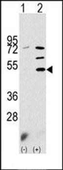 PDK3 antibody