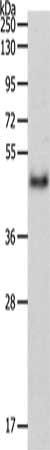 PDK4 Antibody