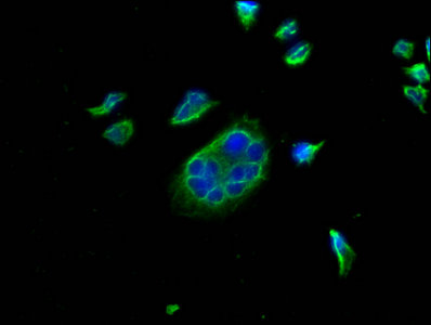 PD-L1 antibody