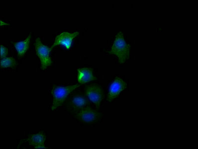 PD-L1 antibody