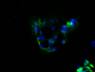 PD-L1 Monoclonal Antibody