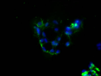 PD-L1 antibody