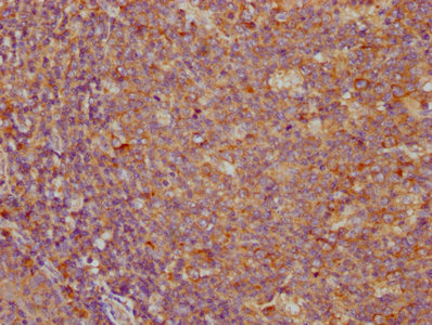 PD-L1 Monoclonal Antibody