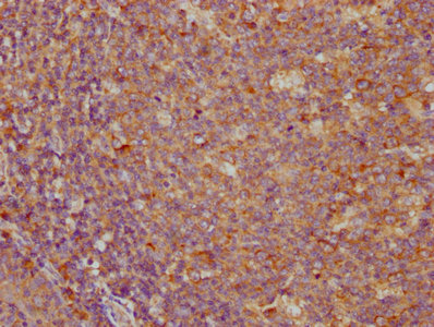 PD-L1 antibody