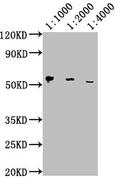 PD-L1 antibody