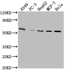 PD-L1 antibody