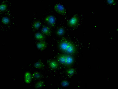 PD-L1 antibody