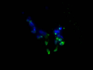 PD-L1 antibody