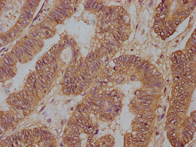 PD-L1 Monoclonal Antibody