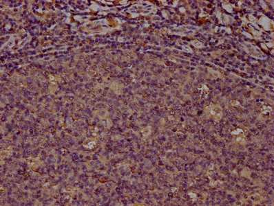 PD-L1 Monoclonal Antibody