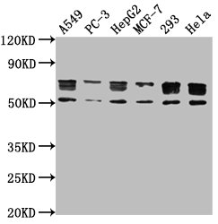 PD-L1 antibody