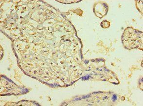 PDLIM1 Antibody