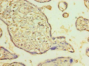 PDLIM1 antibody