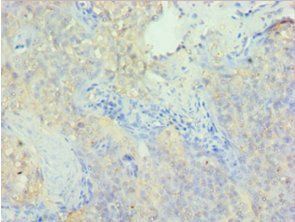 PDLIM1 Antibody