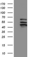 PDLIM2 Antibody