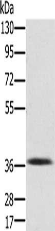 PDLIM2 Antibody