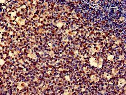 PDLIM2 Antibody