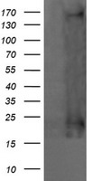 PDLIM5 Antibody