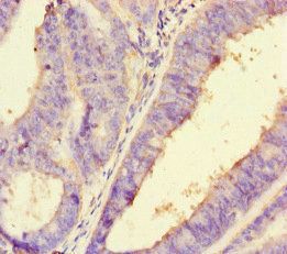 PDLIM5 antibody