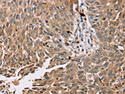 PDLIM7 Antibody
