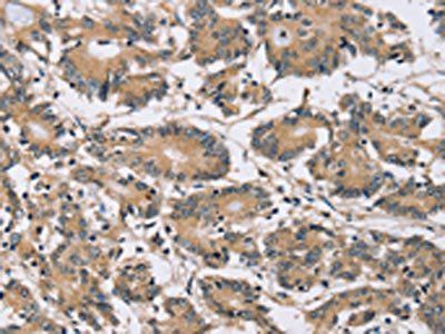 PDLIM7 Antibody