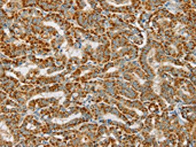 PDP1 Antibody
