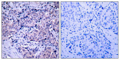 PDPK1 (Ab-241) Antibody