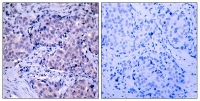 PDPK1 (Ab-241) antibody