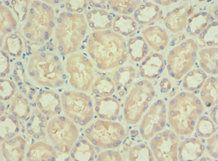 PDPK1 Antibody