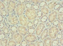 PDPK1 antibody