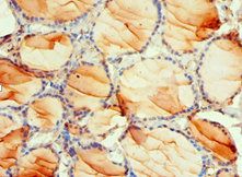 PDPK1 Antibody