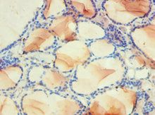 PDPK1 Antibody