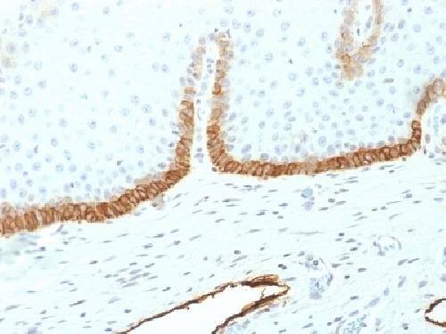 Podoplanin (PDPN) (Lymphatic Endothelial & Mesothelial Marker) Antibody