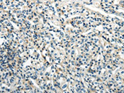PDPN Antibody