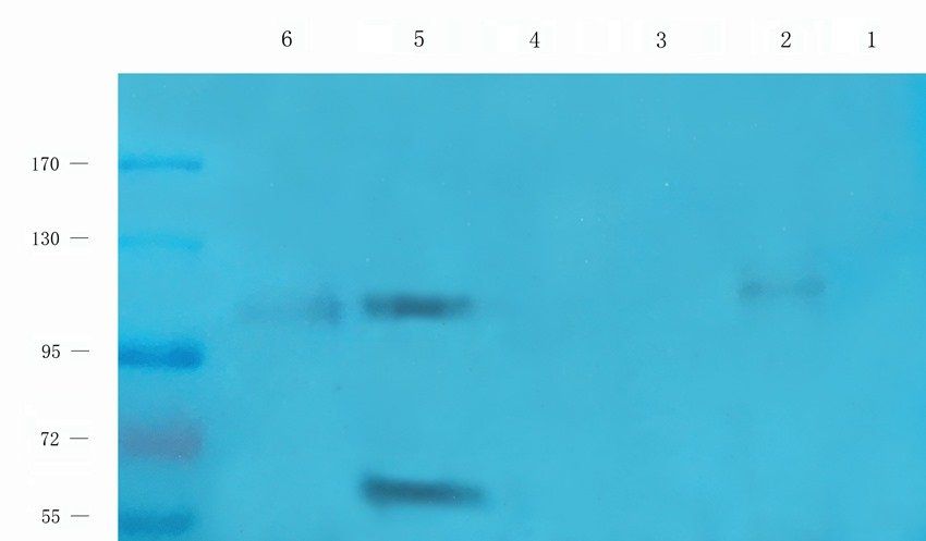 PDS5A antibody