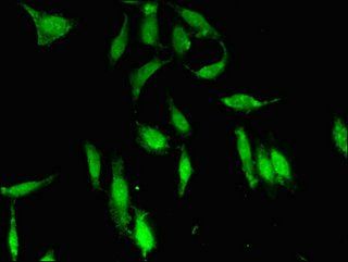 PDS5A antibody