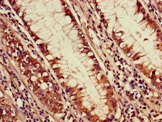 PDS5A Antibody