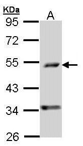 decaprenyl diphosphate synthase subunit 2 Antibody