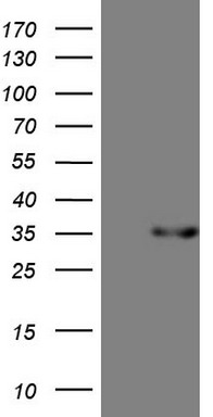 PDX1 Antibody