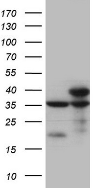 PDX1 Antibody