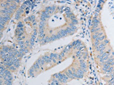 PDX1 Antibody