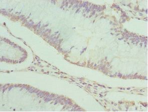 PDXK Antibody