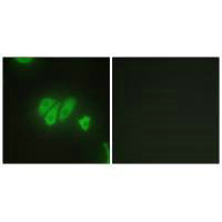 PDZD2 Antibody