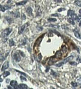 PDZD3 Rabbit Polyclonal Antibody
