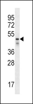 PDZK1 antibody