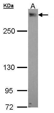EPM2AIP1 antibody [N1], N-term