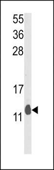 PEA-15 antibody