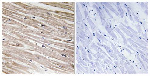 PEA-15 (Phospho-Ser104) Antibody