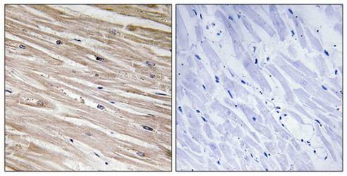 PEA-15 (phospho-Ser104) antibody