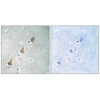 PECAM1 Antibody